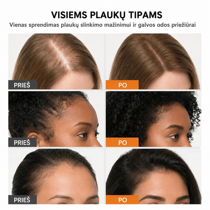 Aume GROW – Plaukų augimo stebuklas