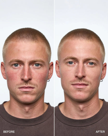 NØVA Skin Veil